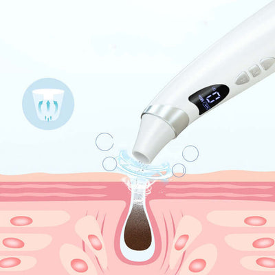 Electric blackhead suction instrument removing impurities from pore, depicted with LED display and magnification illustration.