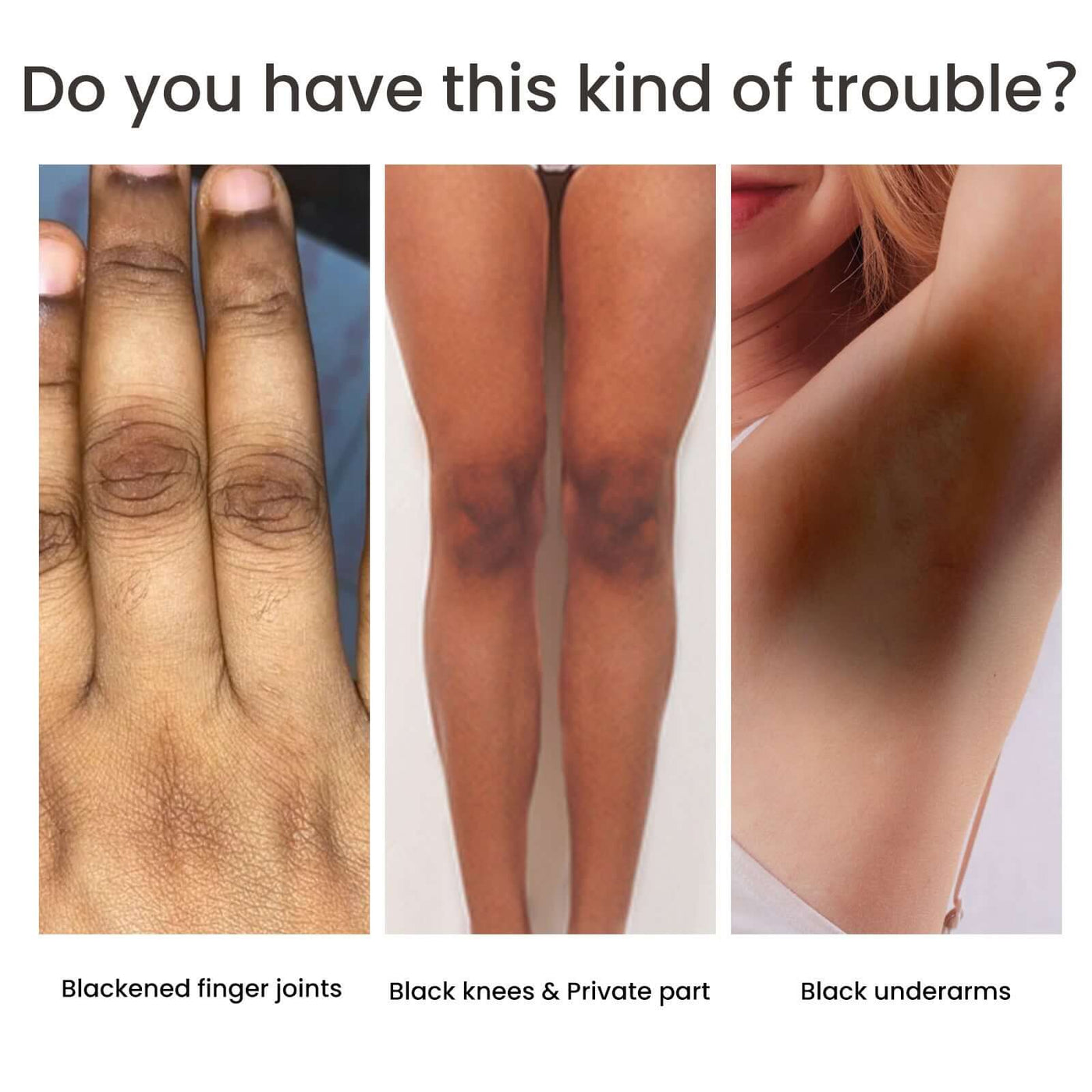 Collage of skin issues including blackened finger joints, knees, and underarms with text "Do you have this kind of trouble?"