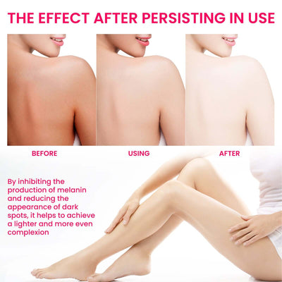 Before and after images showing skin pigmentation treatment on neck and legs, demonstrating improved skin tone from darker spots to even complexion.